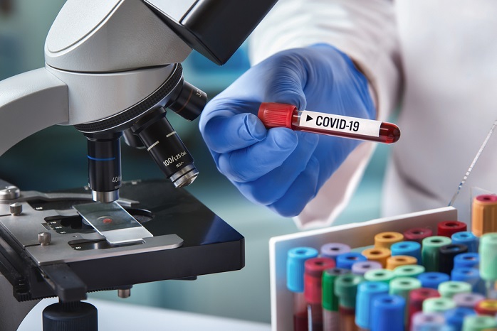 Cara Mengetahui Antibodi Yang Terbentuk Setelah Vaksin Covid-19